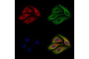 ABIN6255087 and ABIN6267322 staining Hela cells(4h of LPS treatment) by IF/ICC.
