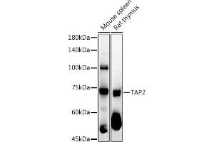 Western Blotting (WB) image for anti-Transporter 2, ATP-Binding Cassette, Sub-Family B (MDR/TAP) (TAP2) (AA 430-680) antibody (ABIN3022237)