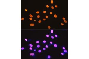Immunofluorescence analysis of NIH-3T3 cells using DDX5 Rabbit mAb (ABIN7266698) at dilution of 1:100 (40x lens). (DDX5 Antikörper)
