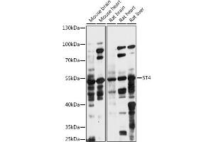 Western blot analysis of extracts of various cell lines, using 5T4 antibody (ABIN7271010) at 1:1000 dilution. (TPBG Antikörper  (AA 32-350))