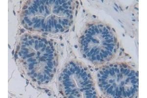 Immunohistochemistry (IHC) image for anti-Collagen, Type IV, alpha 1 (COL4A1) (AA 1444-1669) antibody (ABIN7431209)
