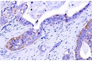 IHC analysis of Claudin 7/CLDN-7 using anti-Claudin 7/CLDN-7 antibody (ABIN7602665).