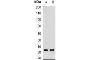 Western blot analysis of SULT1A1 expression in mouse liver (A), rat liver (B) whole cell lysates. (SULT1A1 Antikörper)