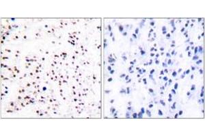 Immunohistochemistry analysis of paraffin-embedded human tonsil tissue, using MCM5 Antibody. (MCM5 Antikörper  (AA 21-70))