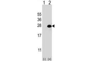 Western blot analysis of DGCR6L (arrow) using rabbit polyclonal DGCR6L Antibody (Center) . (DGCR6L Antikörper  (Middle Region))