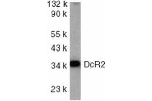 Western blot analysis of DcR2 in HeLa whole cell lysate with AP30280PU-N DcR2 antibody at 1/1000 dilution. (DcR2 Antikörper  (Intracellular))