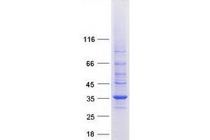 Validation with Western Blot (Stomatin Protein (STOM) (Transcript Variant 1) (Myc-DYKDDDDK Tag))