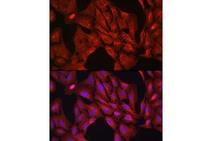 Immunofluorescence analysis of U-2 OS cells using VASP Rabbit pAb (ABIN6134453, ABIN6150064, ABIN6150065 and ABIN6218508) at dilution of 1:100 (40x lens). (VASP Antikörper  (AA 1-100))