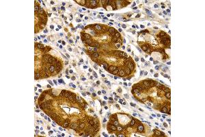 Immunohistochemistry of paraffin-embedded human stomach using TFF1 antibody. (TFF1 Antikörper)