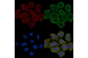 ABIN6262577 and ABIN6279542 staining Hela cells(30 min of UV treatment) by IF/ICC. (IMMP2L Antikörper  (Internal Region))