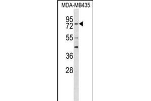 RFX3 Antibody (C-term) (ABIN656557 and ABIN2845819) western blot analysis in MDA-M cell line lysates (35 μg/lane). (RFX3 Antikörper  (C-Term))