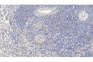 Immunohistochemistry (IHC) image for anti-Caspase 1 (CASP1) (AA 120-297) antibody (ABIN7437272)