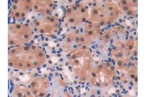 Immunohistochemistry (IHC) image for anti-Dopamine Receptor D1 (DRD1) (AA 338-446) antibody (ABIN7433402)