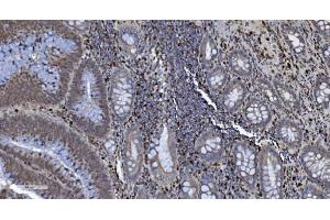 IHC analysis of SAMHD1 using anti-SAMHD1 antibody (ABIN7601514). (SAMHD1 Antikörper  (AA 37-626))