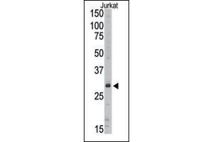 Image no. 1 for anti-Sirtuin 5 (SIRT5) (C-Term) antibody (ABIN358734) (SIRT5 Antikörper  (C-Term))
