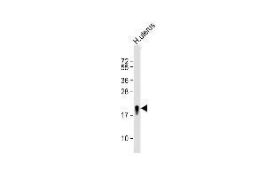 Anti-TAGLN Antibody (N-term) at 1:8000 dilution + H. (Transgelin Antikörper  (N-Term))