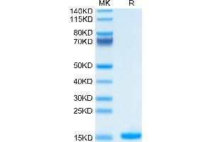 Human IL-2 on Tris-Bis PAGE under reduced condition. (IL-2 Protein (AA 21-153))