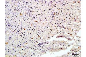 Formalin-fixed and paraffin embedded human brain labeled with Anti-HDAC6 Polyclonal Antibody, Unconjugated (ABIN681058) at 1:200 followed by conjugation to the secondary antibody and DAB staining (HDAC6 Antikörper  (AA 301-400))