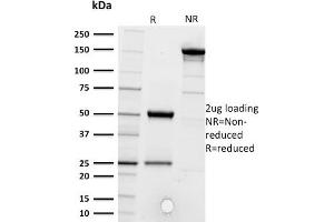 SDS-PAGE Analysis of Purified CD5 Mouse Monoclonal Antibody ABIN6383881. (CD5 Antikörper  (Extracellular Domain))