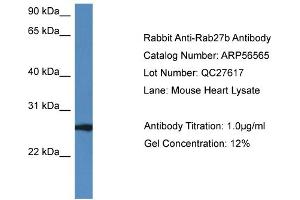 Western Blotting (WB) image for anti-RAB27B, Member RAS Oncogene Family (RAB27B) (C-Term) antibody (ABIN785819) (RAB27B Antikörper  (C-Term))