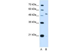 KCNC1 antibody used at 2.