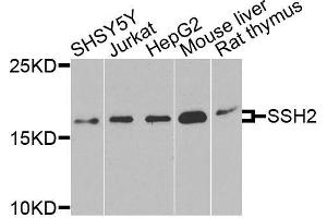 Western blot analysis of extracts of various cell lines, using SSH2 antibody (ABIN6003697) at 1/1000 dilution. (SSH2 Antikörper)
