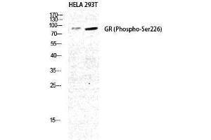 Western Blotting (WB) image for anti-GR (pSer226) antibody (ABIN3182520) (GR (pSer226) Antikörper)