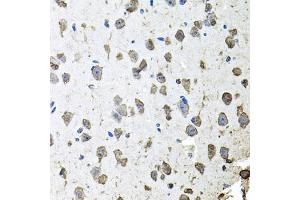 Immunohistochemistry of paraffin-embedded mouse brain using FGF1 antibody (ABIN5970259) at dilution of 1/100 (40x lens). (FGF1 Antikörper)