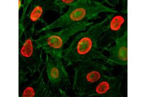 ICC/IF testing of HeLa cells treated with sodium butyrate using recombinant H3K9ac antibody (red). (Rekombinanter Histone 3 Antikörper  (acLys9))