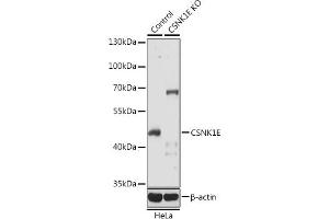 Western blot analysis of extracts from normal (control) and CSNK1E knockout (KO) HeLa cells, using CSNK1E antibody (ABIN6128970, ABIN6139116, ABIN6139117 and ABIN7101448) at 1:1000 dilution. (CK1 epsilon Antikörper  (AA 247-416))