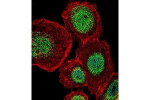 Immunofluorescence (IF) image for anti-Lymphoid Enhancer-Binding Factor 1 (LEF1) antibody (ABIN5016131) (LEF1 Antikörper)