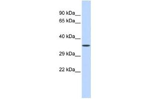 Western Blotting (WB) image for anti-Zinc Finger Protein 124 (ZNF124) antibody (ABIN2458312)