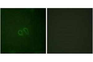 Immunofluorescence analysis of HepG2 cells, using Vinculin (Phospho-Tyr821) Antibody. (Vinculin Antikörper  (pTyr821))