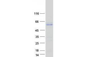 Western Blotting (WB) image for Thymopoietin (TMPO) (Transcript Variant 2) protein (Myc-DYKDDDDK Tag) (ABIN2733921)