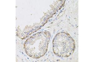 Immunohistochemistry of paraffin-embedded human prostate using CIB1 antibody. (CIB1 Antikörper  (AA 1-191))