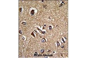 Immunohistochemistry (Paraffin-embedded Sections) (IHC (p)) image for anti-Serine/threonine Kinase Receptor Associated Protein (STRAP) (AA 242-269), (C-Term) antibody (ABIN389479)