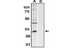 Image no. 1 for anti-B-Cell CLL/lymphoma 10 (BCL10) (AA 5-19) antibody (ABIN264992) (BCL10 Antikörper  (AA 5-19))