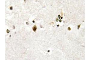 Immunohistochemistry analysis of HES-6 antibody in paraffin-embedded human brain tissue. (HES6 Antikörper)