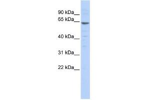 WB Suggested Anti-ZNF192 Antibody Titration:  0. (ZNF192 Antikörper  (N-Term))