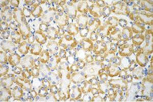 Immunohistochemistry was performed on paraffin-embedded mouse kidney using ACAT1 antibody (ABIN7797438), 1:200). (ACAT1 Antikörper)