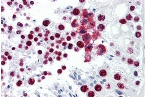 Human Testis: Formalin-Fixed, Paraffin-Embedded (FFPE) (CDKL1 Antikörper  (AA 259-358))
