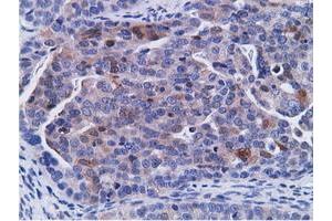 Immunohistochemical staining of paraffin-embedded Human Kidney tissue using anti-CD80 mouse monoclonal antibody. (CD80 Antikörper)