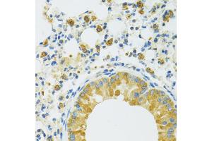 Immunohistochemistry of paraffin-embedded mouse lung using SLC37A4 antibody. (SLC37A4 Antikörper)