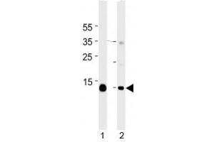 Myoglobin antibody western blot analysis in mouse 1) heart and 2) skeletal muscle tissue lysate.