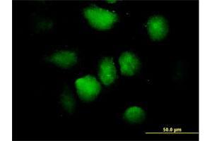 Immunofluorescence of purified MaxPab antibody to ZNF74 on HeLa cell. (ZNF74 Antikörper  (AA 1-644))