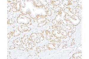 Immunohistochemistry (IHC) image for anti-ThPok (AA 250-300) antibody (ABIN7453988)