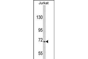 Western blot analysis of hUSP19- (ABIN388908 and ABIN2839191) in Jurkat cell line lysates (35 μg/lane). (USP19 Antikörper  (C-Term))