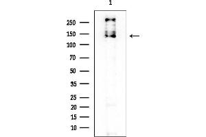 anti-DAZ Interacting Protein 3, Zinc Finger (DZIP3) (Internal Region) antibody