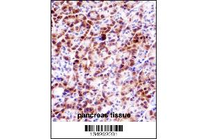 PRSS27 Antibody immunohistochemistry analysis in formalin fixed and paraffin embedded human pancreas tissue followed by peroxidase conjugation of the secondary antibody and DAB staining.