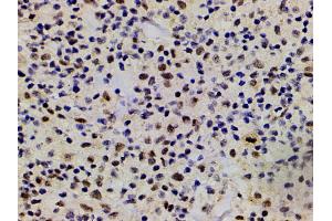 Immunohistochemistry (IHC) image for anti-LIM Domain Kinase 1 (LIMK1) (pThr508) antibody (ABIN6255701)